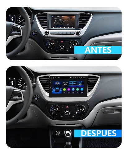 Android Hyundai Accent 2018-2022 Gps Radio Touch Carplay Hd Foto 8