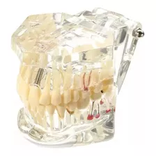 Modelo Dentári Boca Inteira Dente Dentista.