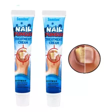 Crema Ungüento Para Hongo De Uñas - g a $1050