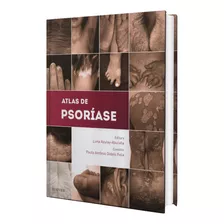 Livro Atlas De Psoriase - Luna Azulay Abulafia, 1ª Edição 2014