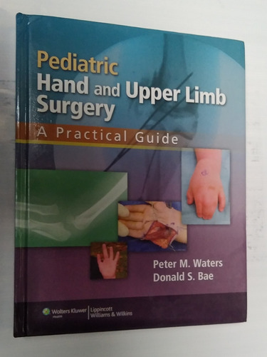 Livro Pediatric Hand Upper Limb Surgery Capa Dura 658pg