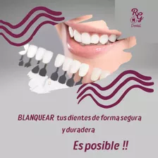 Blanqueamiento Dental