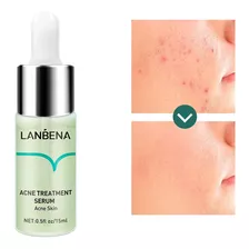 Serum Lanbena Anti Acné Tratamiento 15ml Cuidado Facial Tipo De Piel Normal