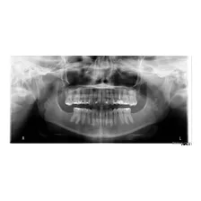 Panorámica Dental