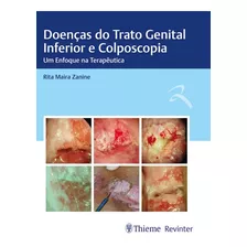 Doencas Do Trato Genital Inferior E Colposcopia