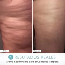 Crema Reafirmante Para Contorno Corporal Neora Firm Original