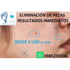 Eliminacion De Pecas