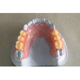 ReparaciÃ³n Y ConfecciÃ³n De PrÃ³tesis Dentales MecÃ¡nico Dental