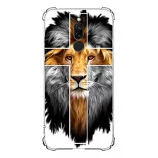 Capa Capinha Anti Shock Para Redmi 9