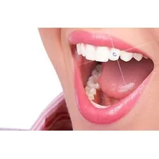 Piercing Para Dente - Cor Cristal