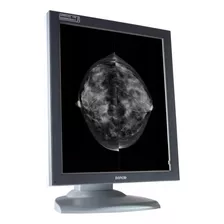 Monitor Barco 5mp Grado Medico Para Mastografía 