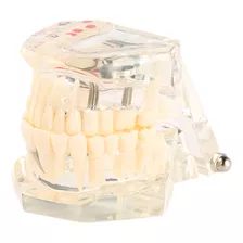 Herramienta De Enseñanza De Dientes Para Implantes Dentales