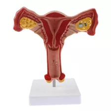 1:1 Modelo De Útero Ovario Humano Femenino Trompas De Falopi