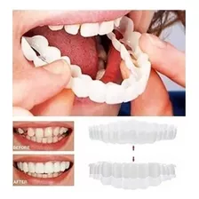 Sorriso Superior/inferior Facetas De Dentes Falsos