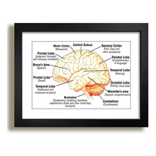 Quadro Medicina Cerebro Humano Anatomia Clinica Hospital