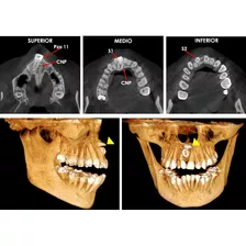 Rayos X General Tomografía Y Panorámica Dental Odontologia 