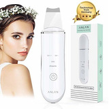 Limpiador Facial Peeling Ultrasónico Portatil Skin Scrubber