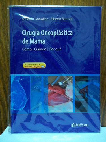 Cirugía Oncoplástica De Mama. - Gonzalez