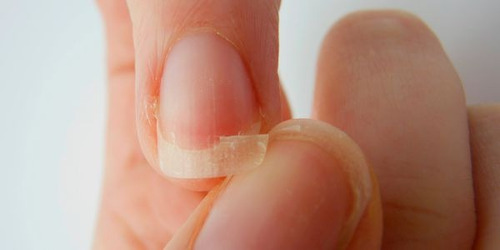 Imagem 6 de 7 de 1 Cabelos E Unhas Proway 60cps + Óleo De Rícino 30ml +brinde