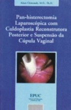 Pan-histerectomia Laparoscópica Com Culdoplastia