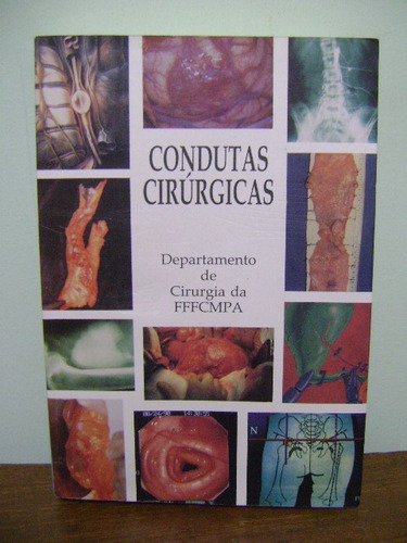 Livro Condutas Cirúrgicas Telmo Pedro Bonamigo Fffcmpa