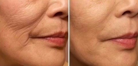 Crema Colageno Antiarrugas Fontbote Revitalizante Tensora