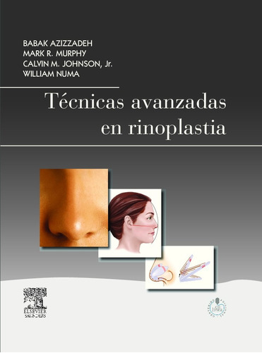 Azizzadeh - Técnicas Avanzadas En Rinoplastía