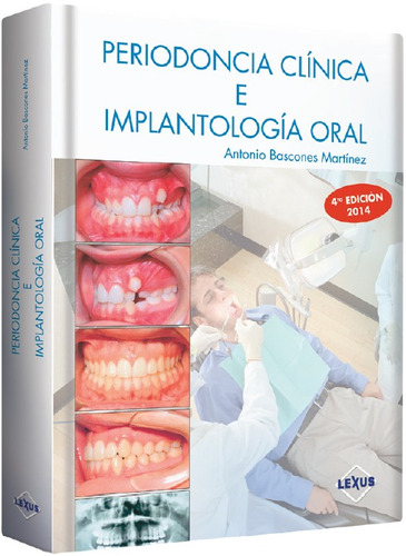 Libro Periodoncia Clinica E Implantologia Oral