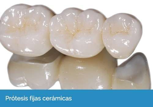 Dentista - Prótesis Dentales - Implantes - Extracciones