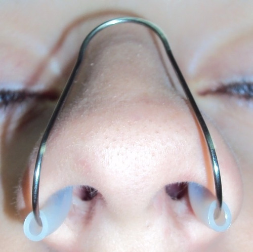 Nasalopen - Dilatador Nasal Inox C/ 2 (dois)earclean Grátis