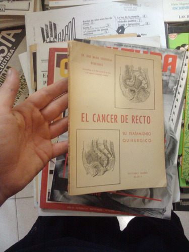 El Cancer De Recto Su Tratamiento Quirurgico Rodriguez