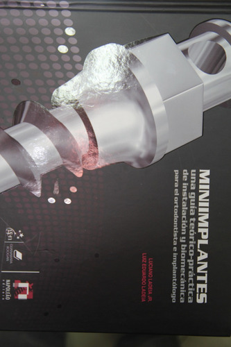 Miniimplantes Para Ortodontistas