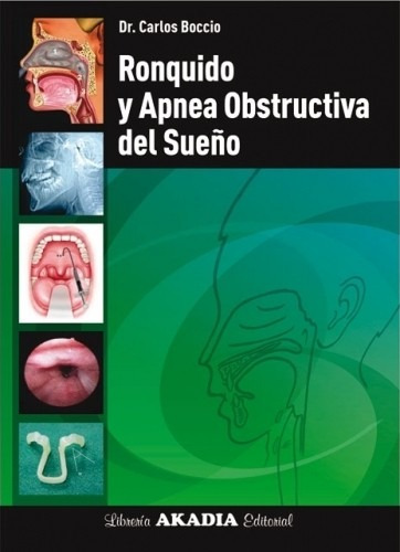 Boccio Ronquido Y Apnea Obstructiva Nuevo Envios Acep Mp Me