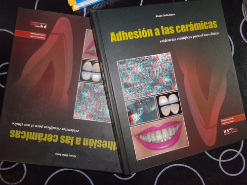 Adhesion  A Las Ceramicas, Della Bona -rf Libros Odontologia