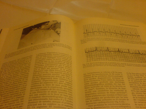 Anestesia En Cardiologia- (tomo) (joel A Kaplan)-doyma-unico