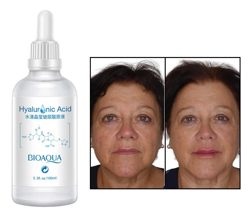 Kit X3 Serum Hialuronico Bioaqu - mL a $329