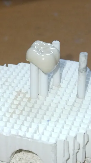 Placas Dentales: Acrilico Porcelana Y Más