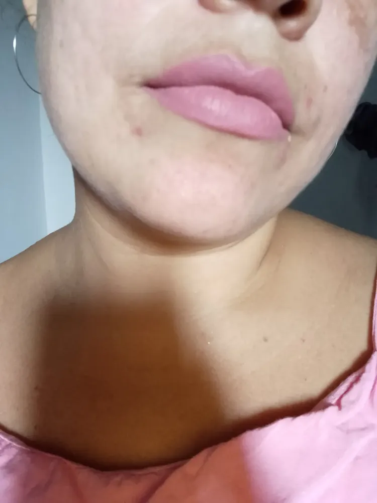 Foto do produto compartilhada pelo comprador 1 de 4