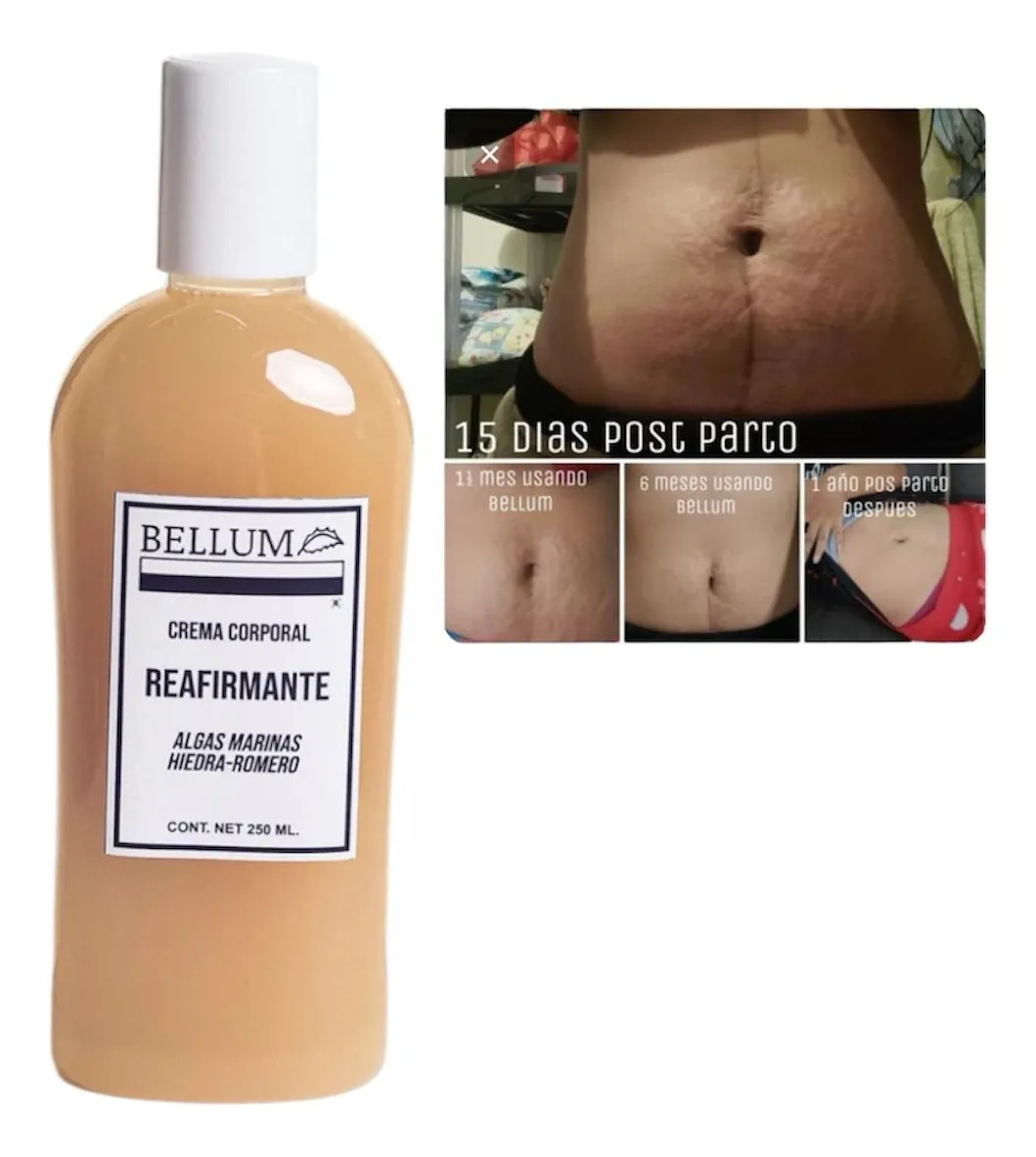 Crema Corporal Reafirmante Estrías Bellum