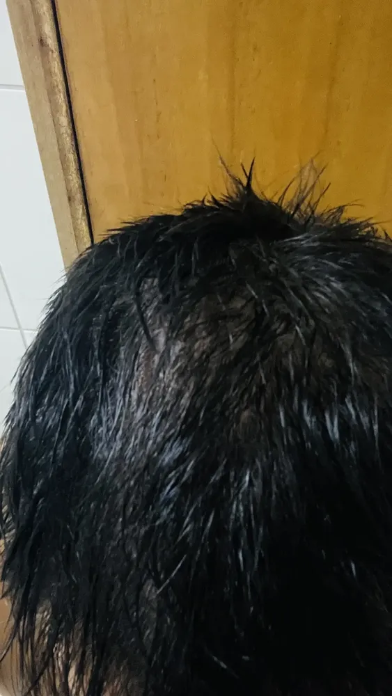 Foto do produto compartilhada pelo comprador 1 de 5