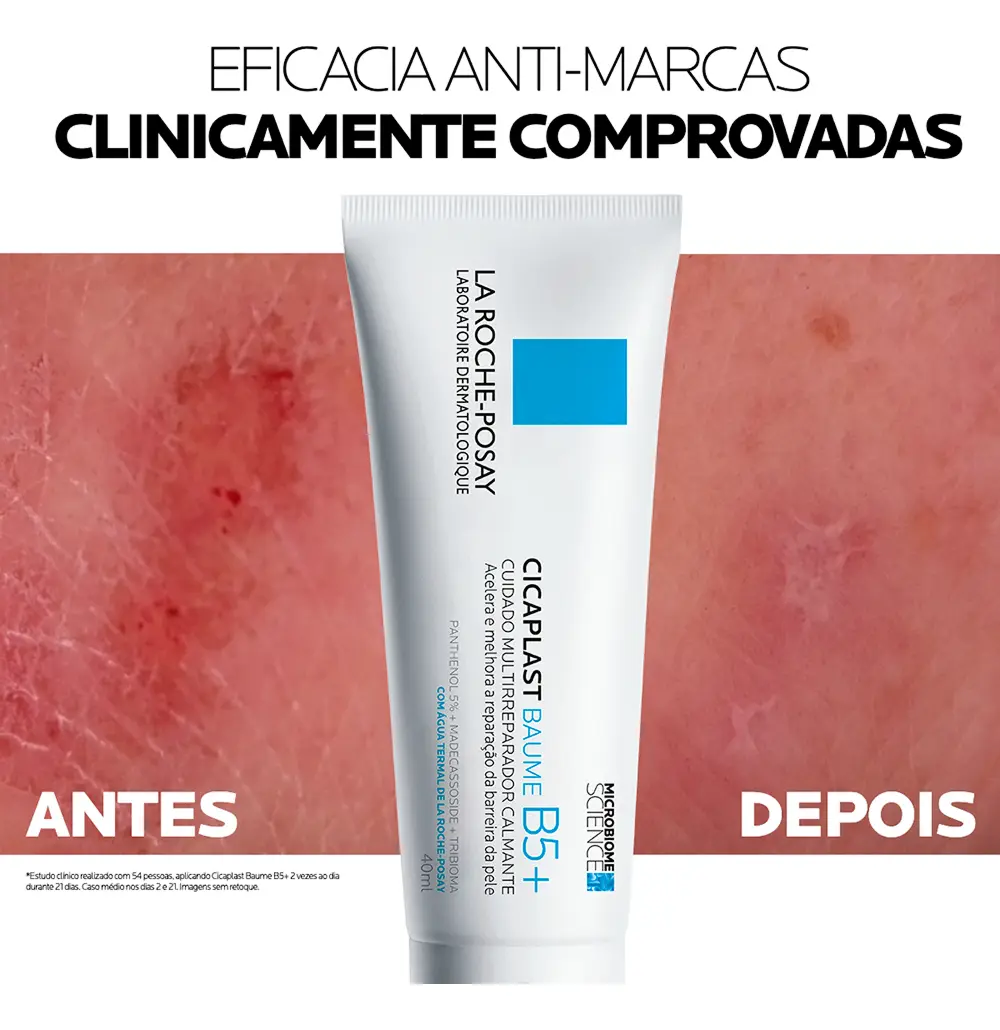 Imagem demonstrativa de antes e depois da pele tratada com Cicaplast Baume B5+, destacando a eficácia anti-marcas