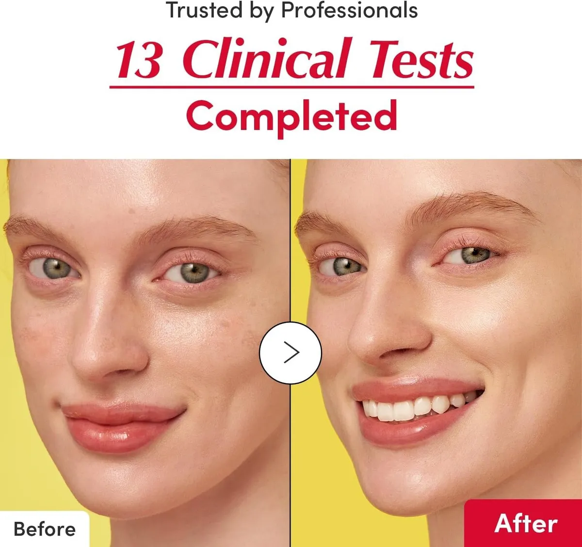 Eqqualberry Suero Iluminador Con Vitamina C Momento De Aplicación Día/noche Tipo De Piel Normal