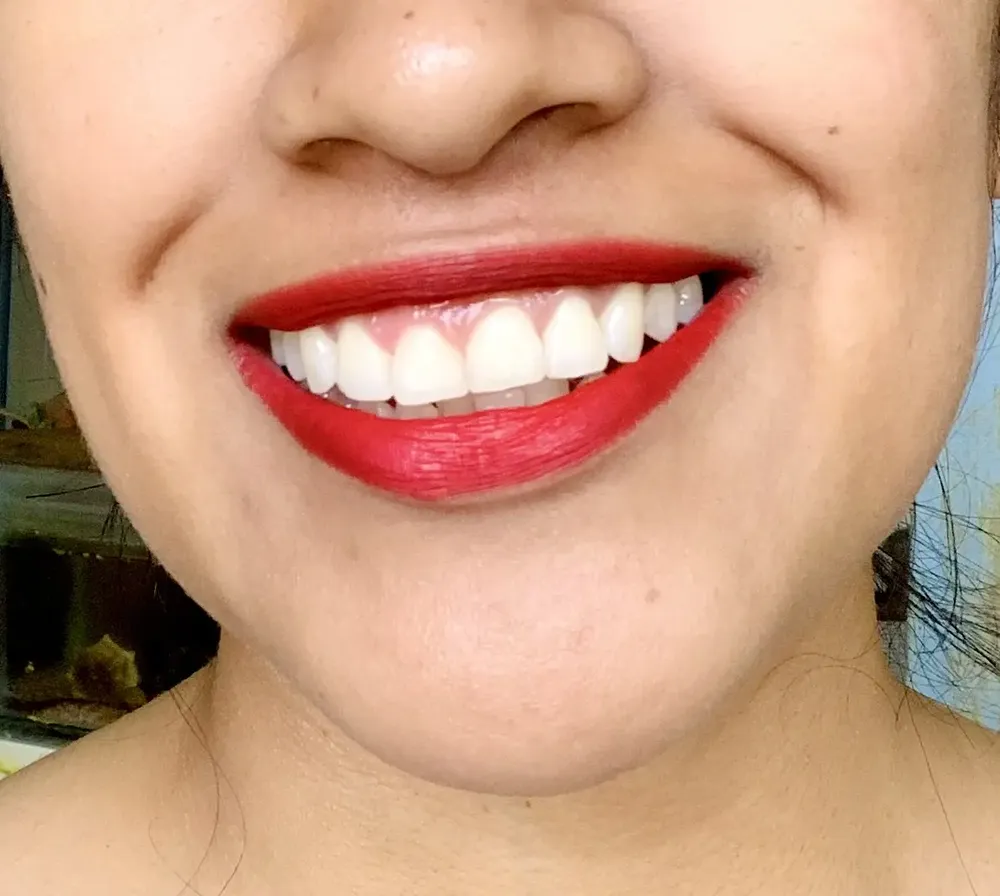 Foto do produto compartilhada pelo comprador 4 de 5