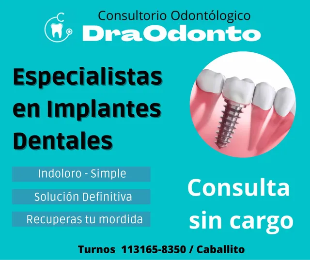Oportunidad Implantes Dentales 100% Calificados Positivos 