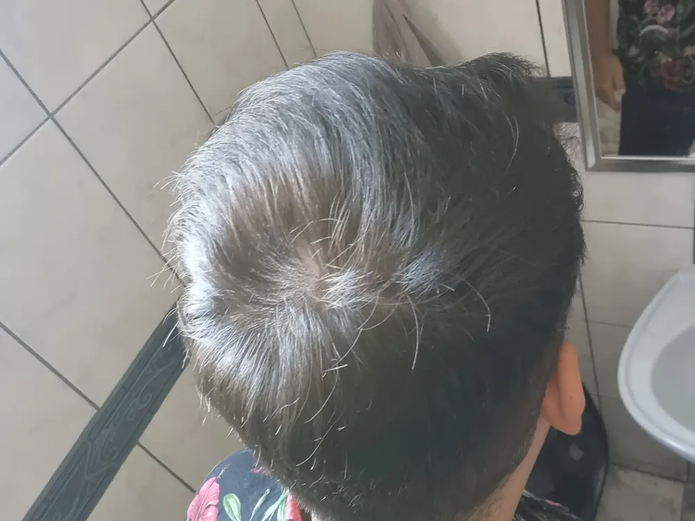 Foto do produto compartilhada pelo comprador 5 de 5
