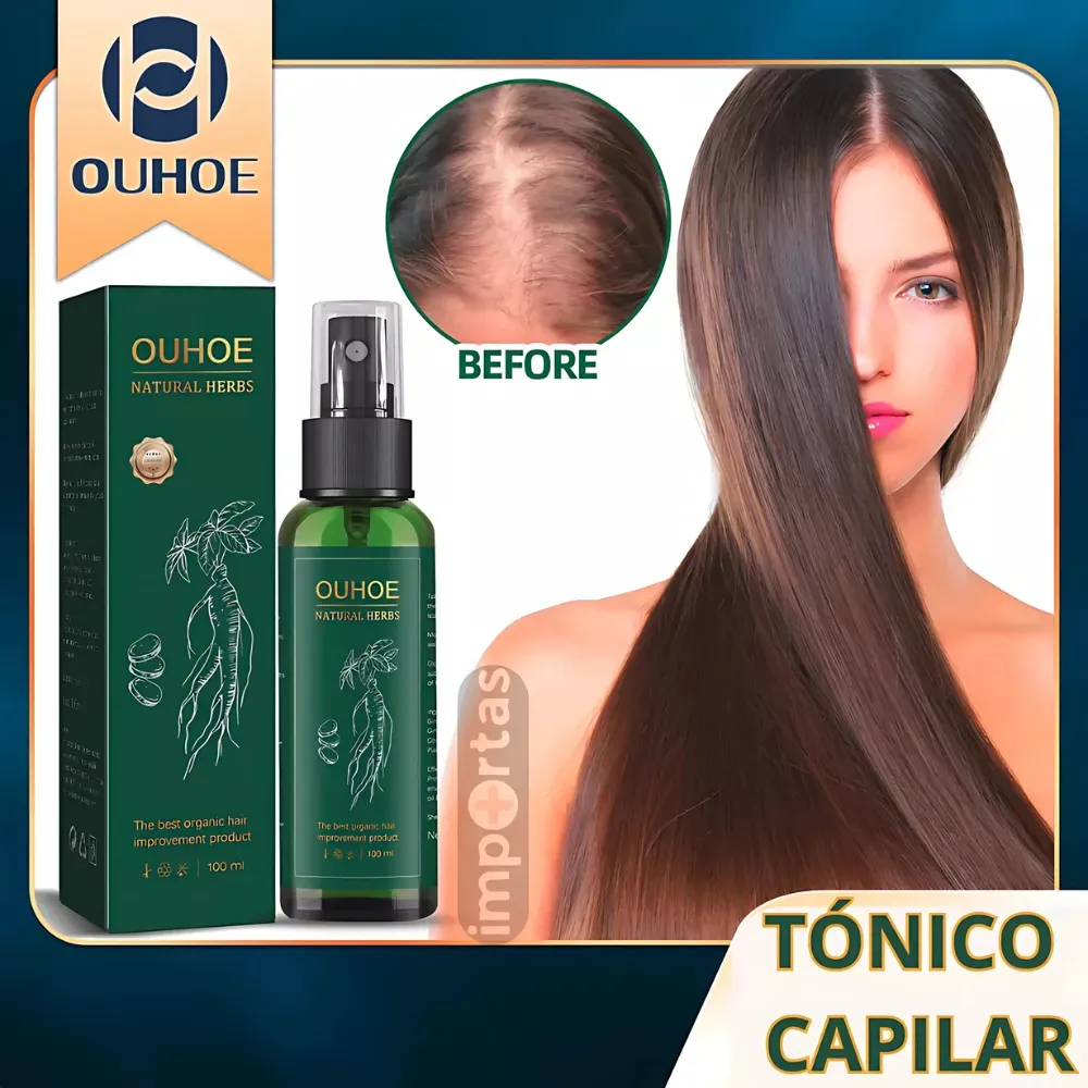 Ouhoe 100ml Control De Caida Y Crecimiento De Cabello