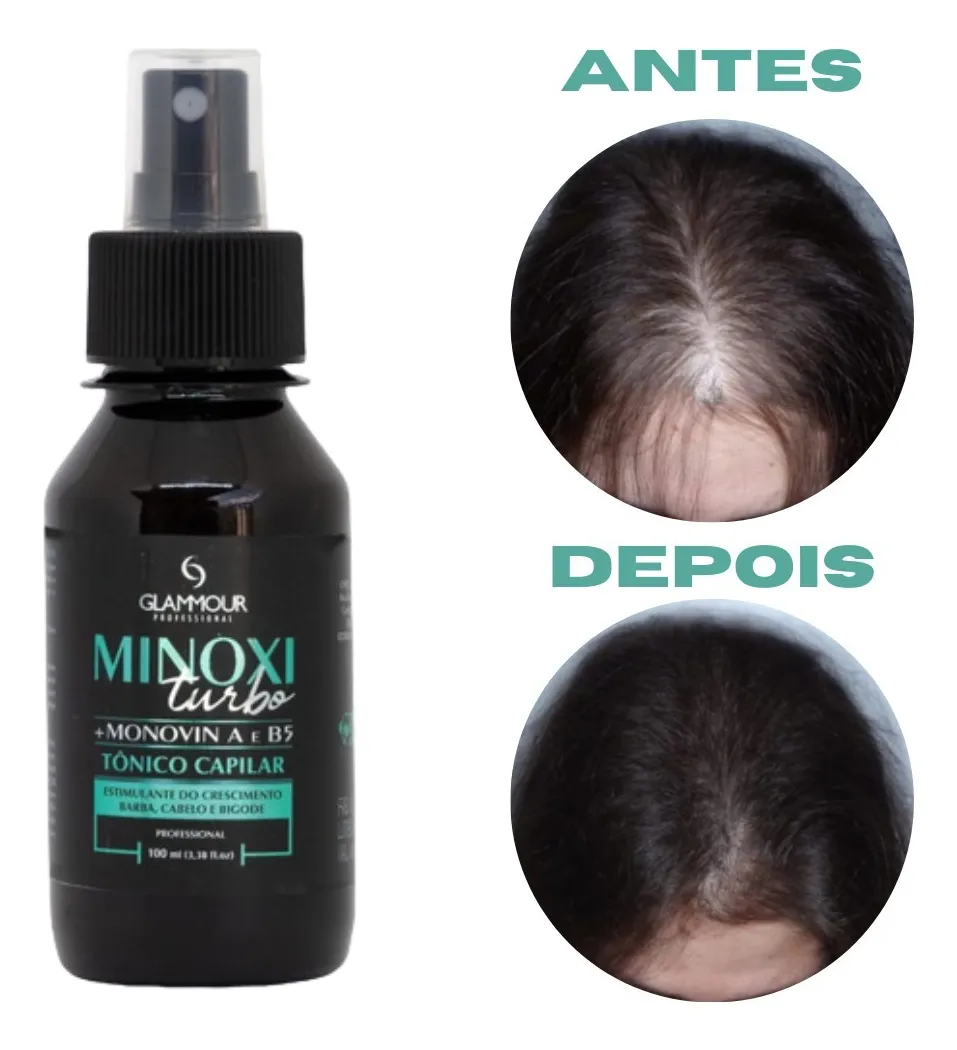 Tônico Capilar Minoxi