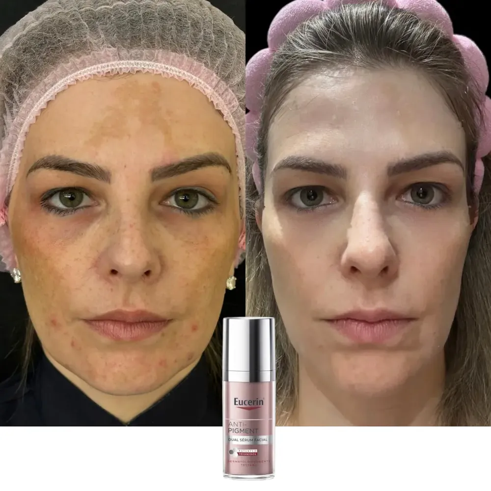 Foto do produto compartilhada pelo comprador 4 de 5