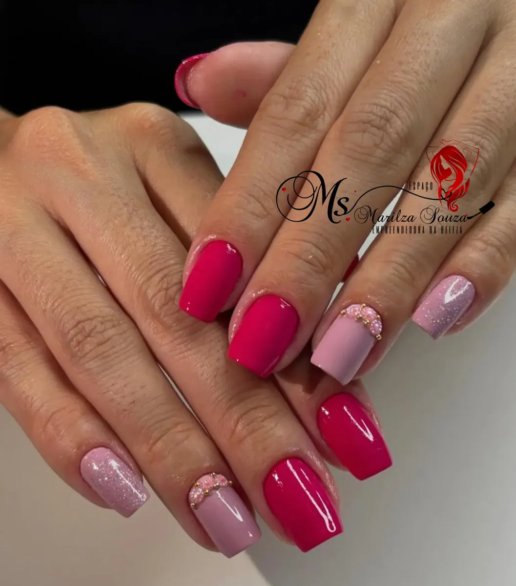 Unhas 