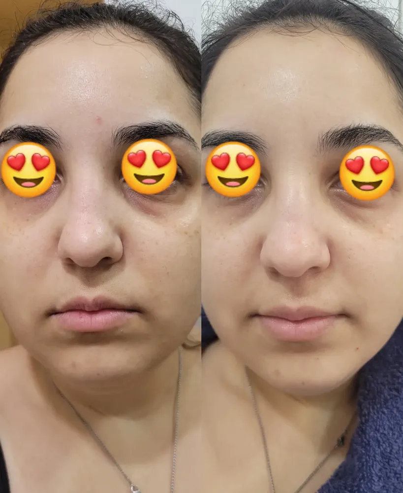 Foto do produto compartilhada pelo comprador 2 de 5